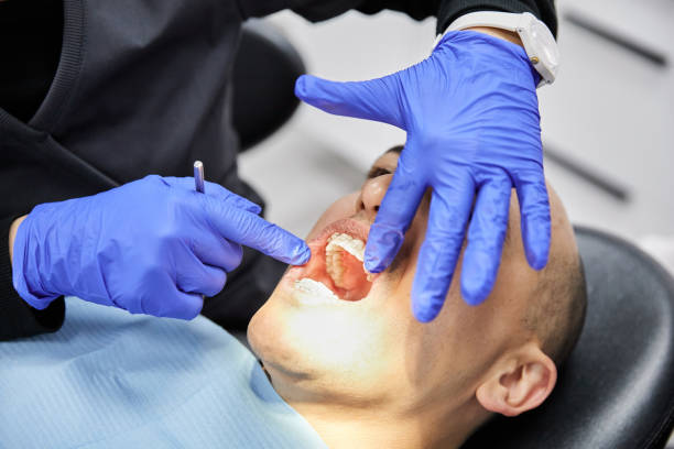 Best Knocked-Out Tooth Emergency  in Black Hammock, FL